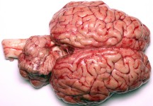 Brain photo